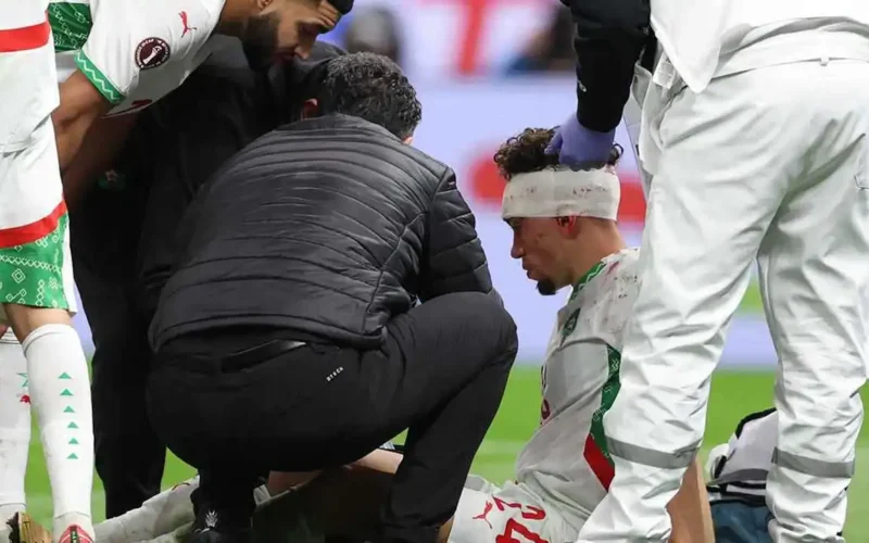 نزيف غزير في وجهه.. إصابة نجم المغرب أمام منتخب السنغال